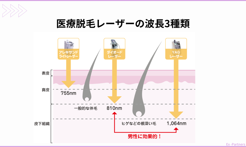 医療脱毛レーザーの3波長