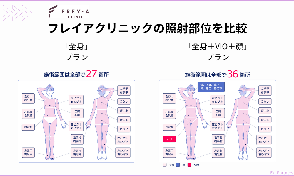 フレイアクリニックの全身脱毛プラン比較