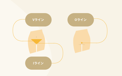 リゼクリニックVIO